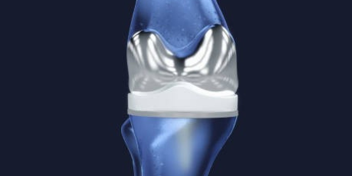 3D-Printed Hip and Knee Implant Market Demand Rises with Global Regulatory Advancements and Certification Frameworks