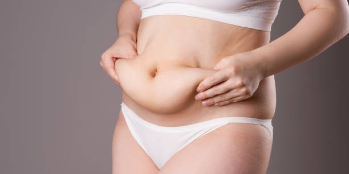 Tummy Tuck Surgery in Dubai: Full Guide to Procedure Costs