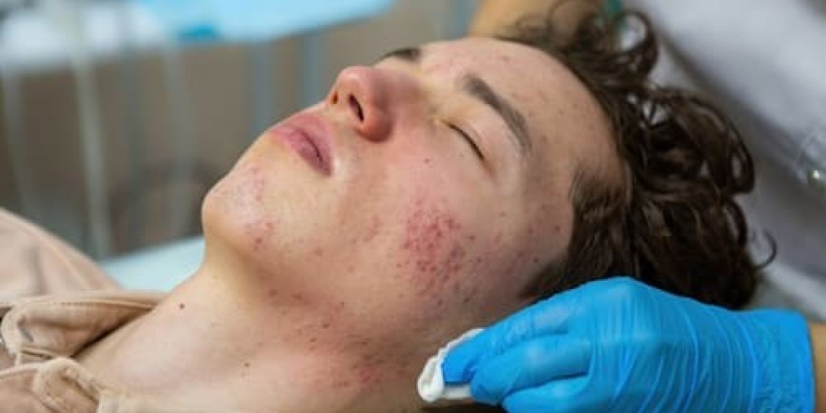 Does acne treatment lower acne-related redness?