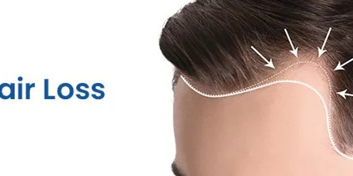 Hairfall Checkup Package in Hyderabad | Accurate Diagnosis for Healthy Hair
