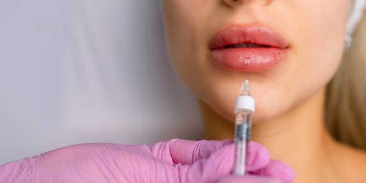 Lip Fillers Injection in Dubai with FDA-Approved Products