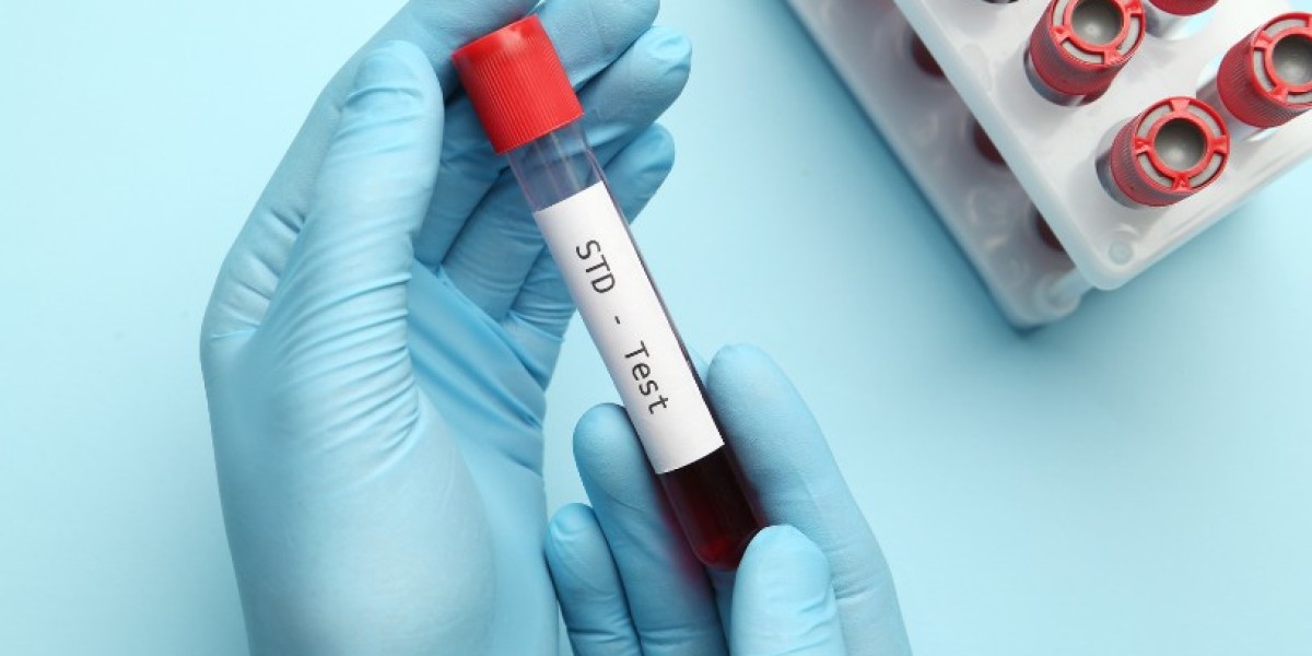 STD Test for LGBTQ+ Individuals: Inclusive Guide