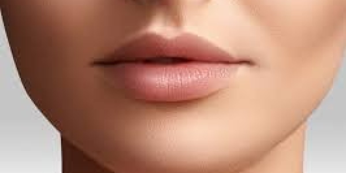 What Exactly Are Russian Lip Fillers, and How Is the Treatment Performed?