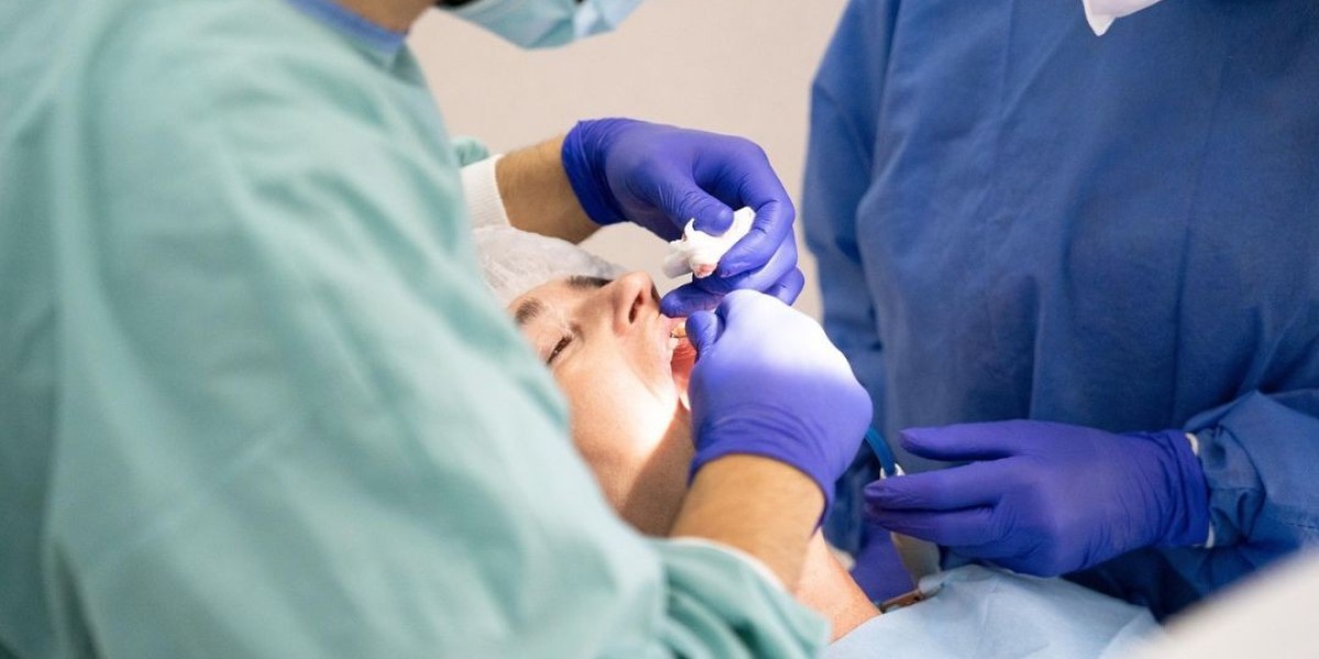 All-on-4 Implants: Revolutionizing Full Arch Replacement
