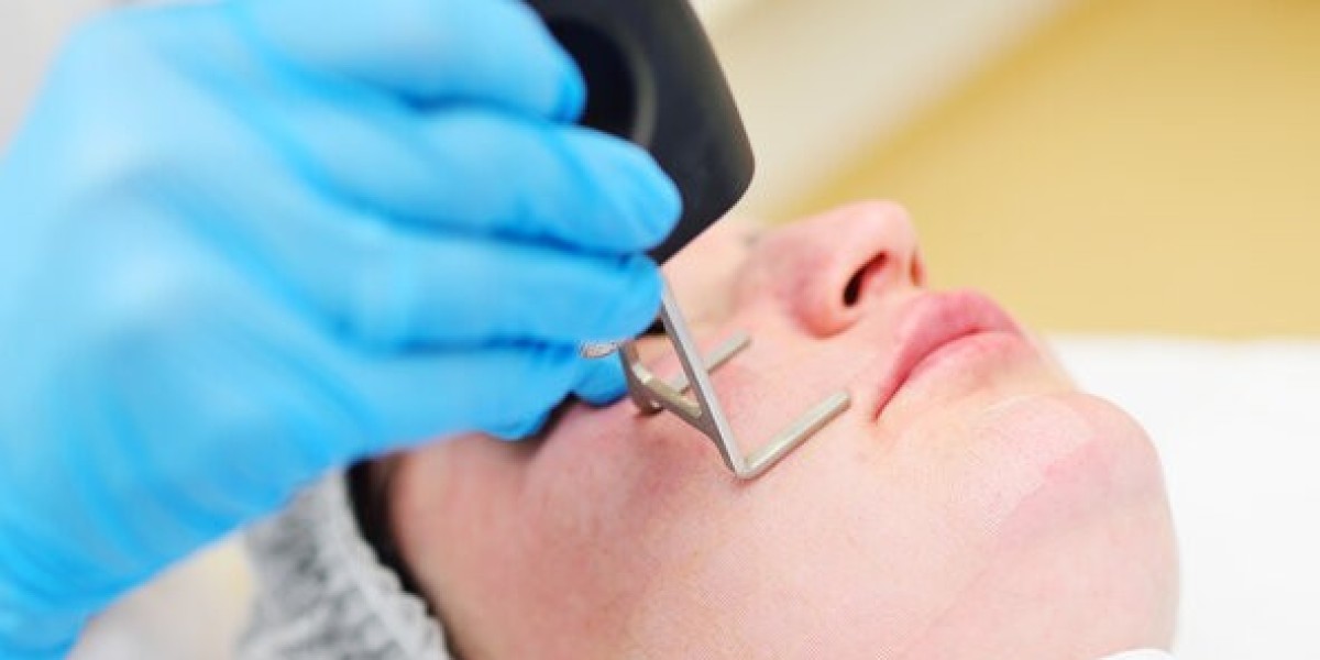 Can I remove acne scars permanently now?