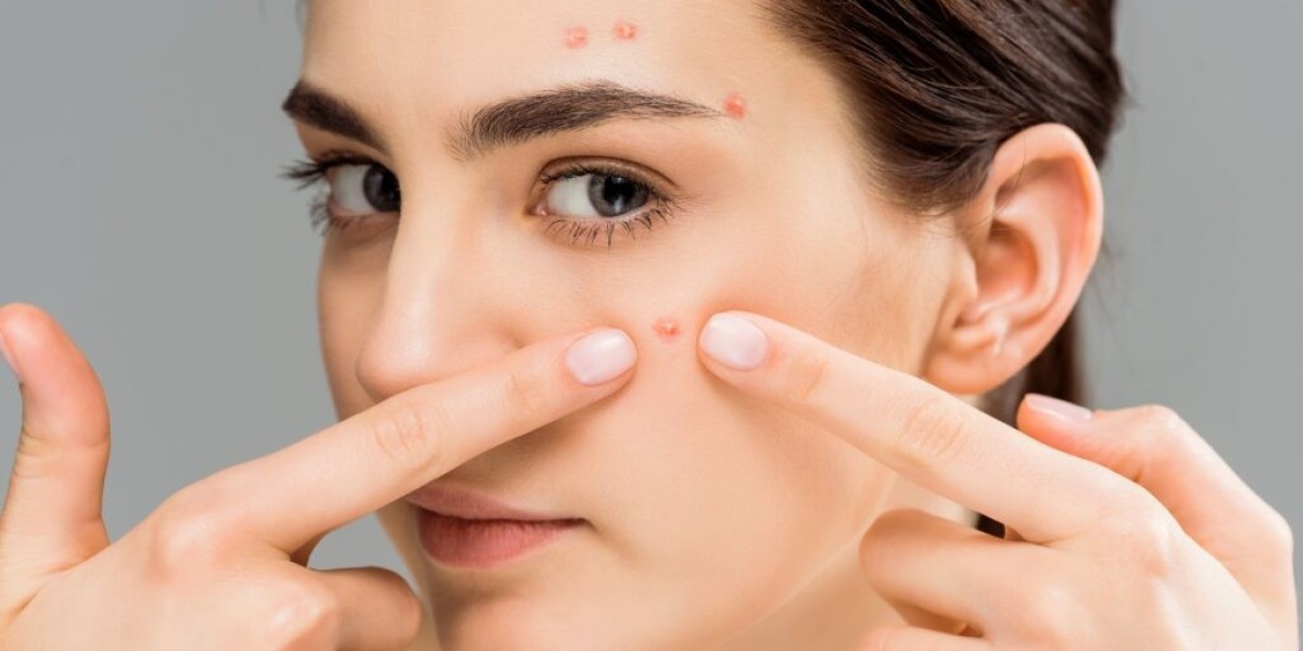 How Brad Pitt’s Acne Scar Treatment Supports Skin Health