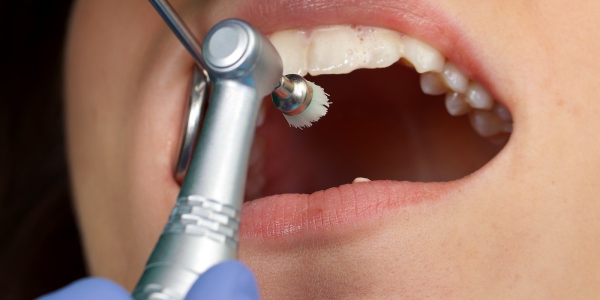Teeth Cleaning can it reduce plaque fast?