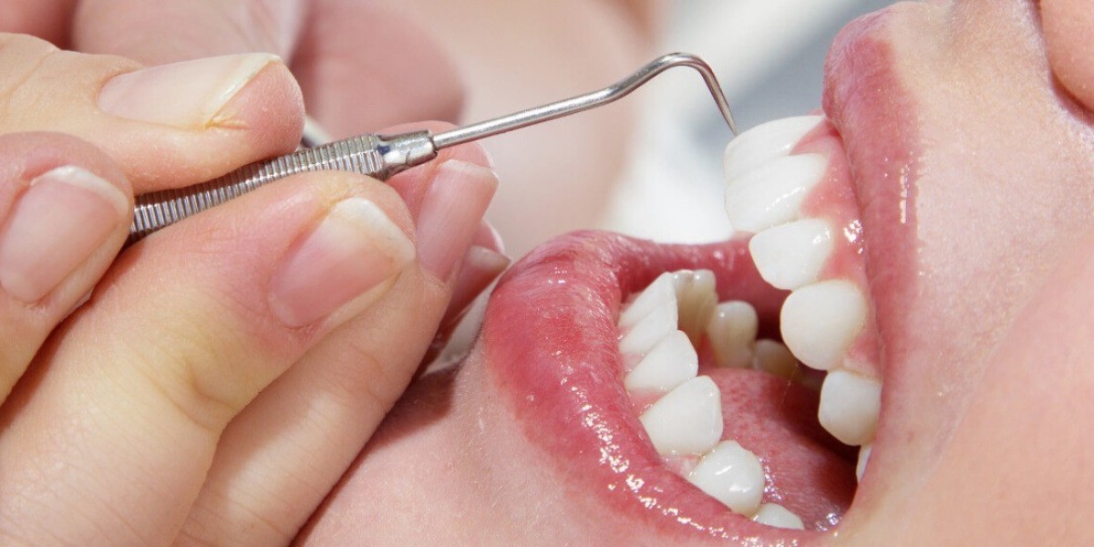 How Does Teeth Cleaning in Dubai Improve Your Smile?