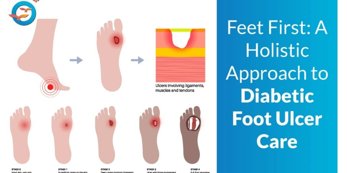 Diabetic Foot Ulcer and Neuropathy
