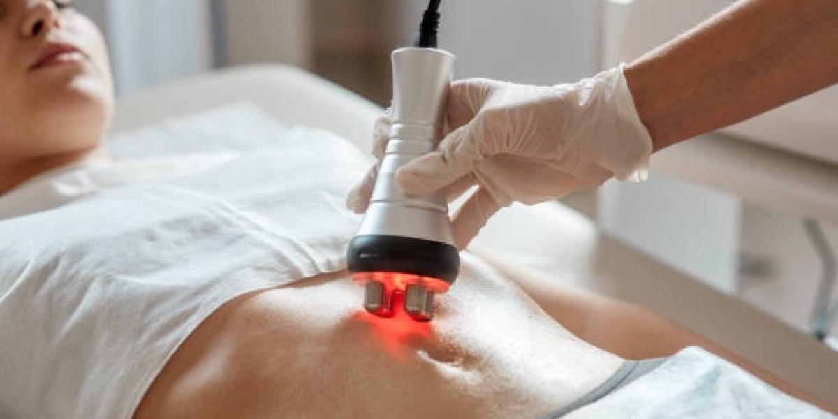 Explore CoolSculpting Fat Freezing for a More Defined Silhouette