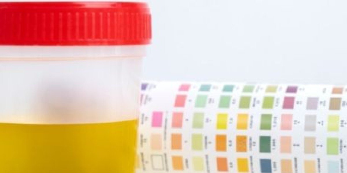Urine Calcium-Creatinine Ratio Test: Key to Kidney Stone Prevention