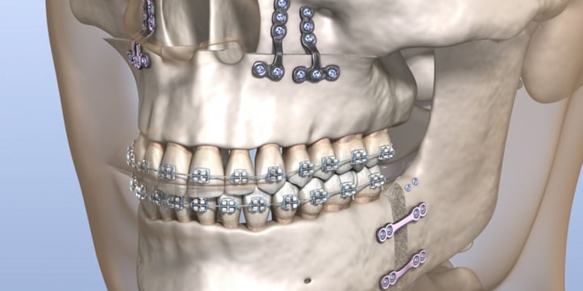 How Age Influences Jaw Surgery Outcomes in Islamabad