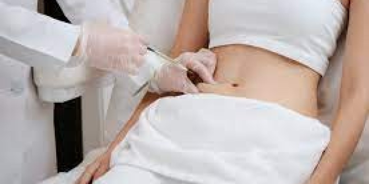 How Does Liposuction Help With Excess Skin Removal?