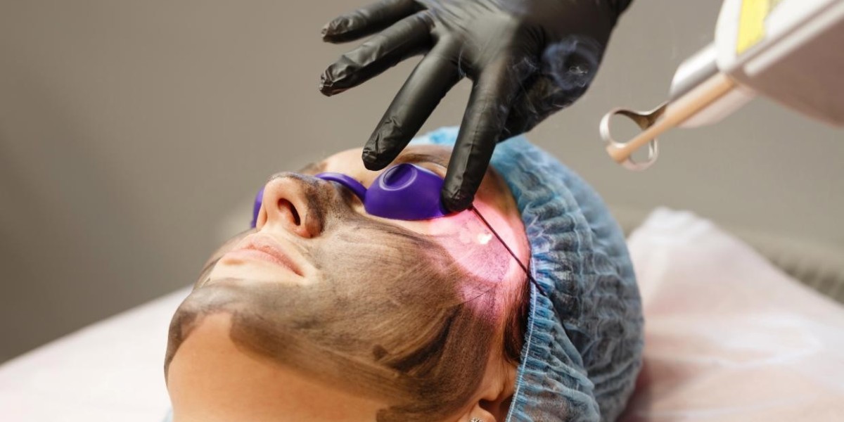 Fast Skin Brightening with Laser Carbon Peel – Glamorous Clinic Dubai