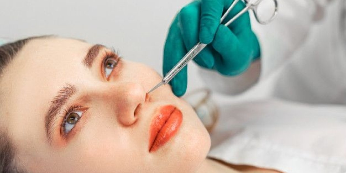 Rhinoplasty in Dubai: How to Manage Nervousness Before Surgery