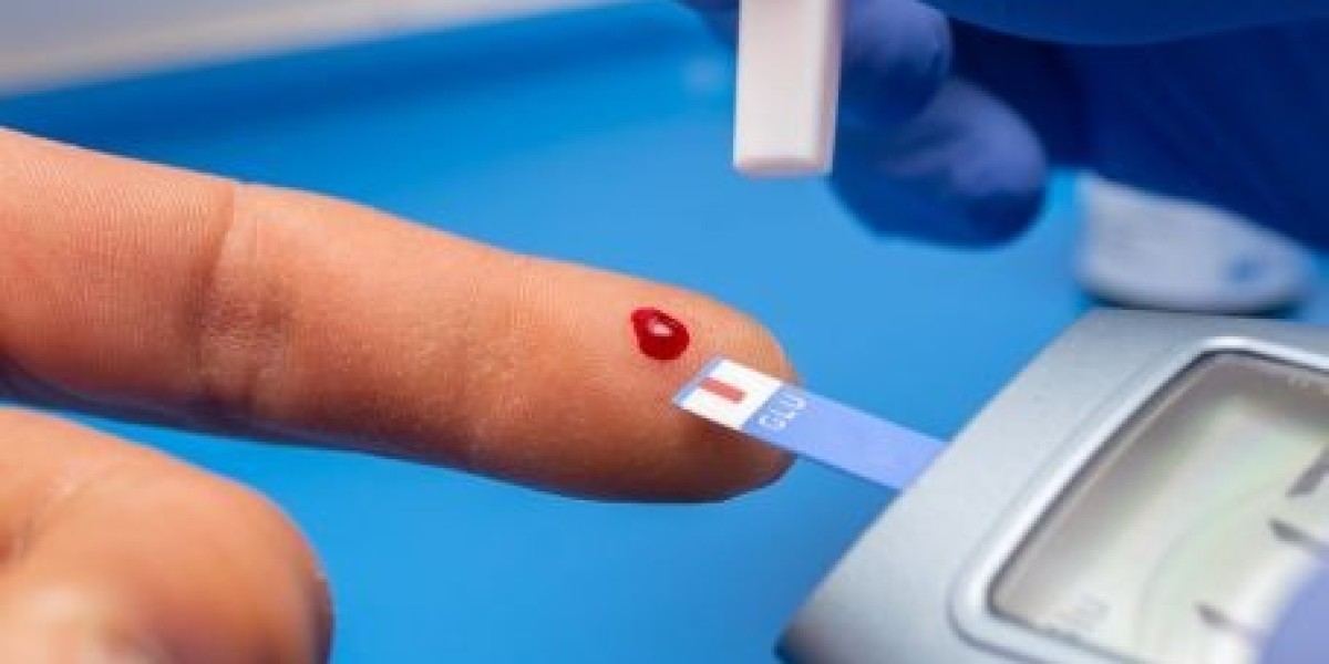Diabetes and Dental Implants: How Blood Sugar Levels Affect Implant Success