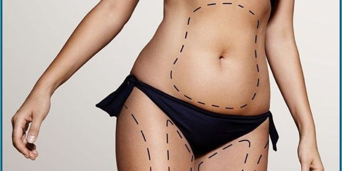 Best Clinics for Liposuction in Dubai: What to Look For