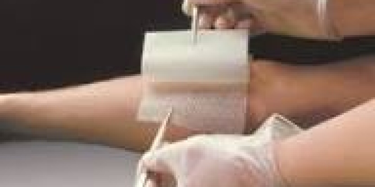 Antimicrobial Dressing Market Boosted by Increasing Preference for Hydrocolloid Antimicrobial Products
