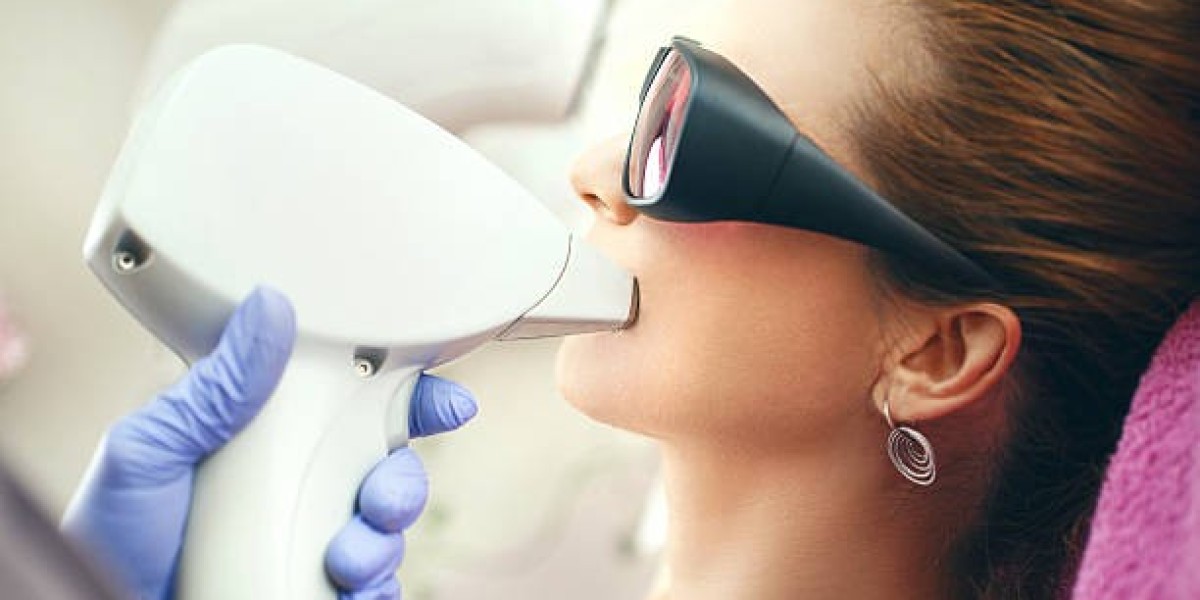 Laser Hair Removal for Face: Achieve Flawless Results