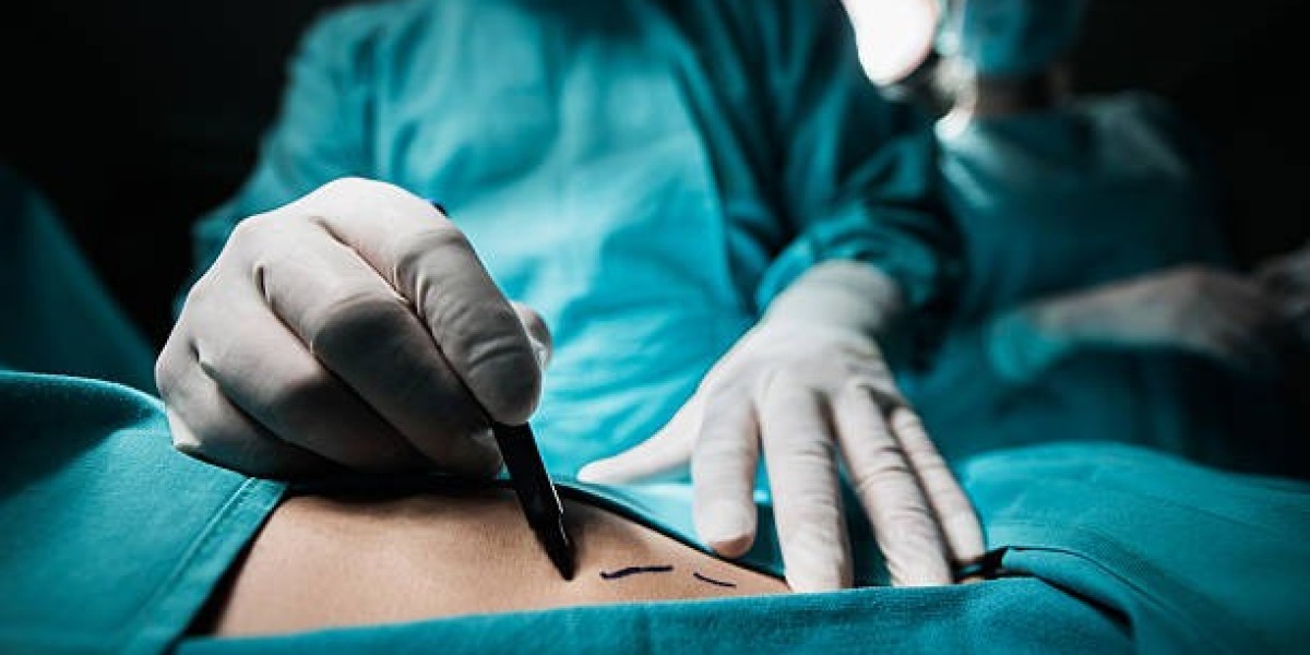 Dubai Liposuction: The Ultimate Guide for Beginners