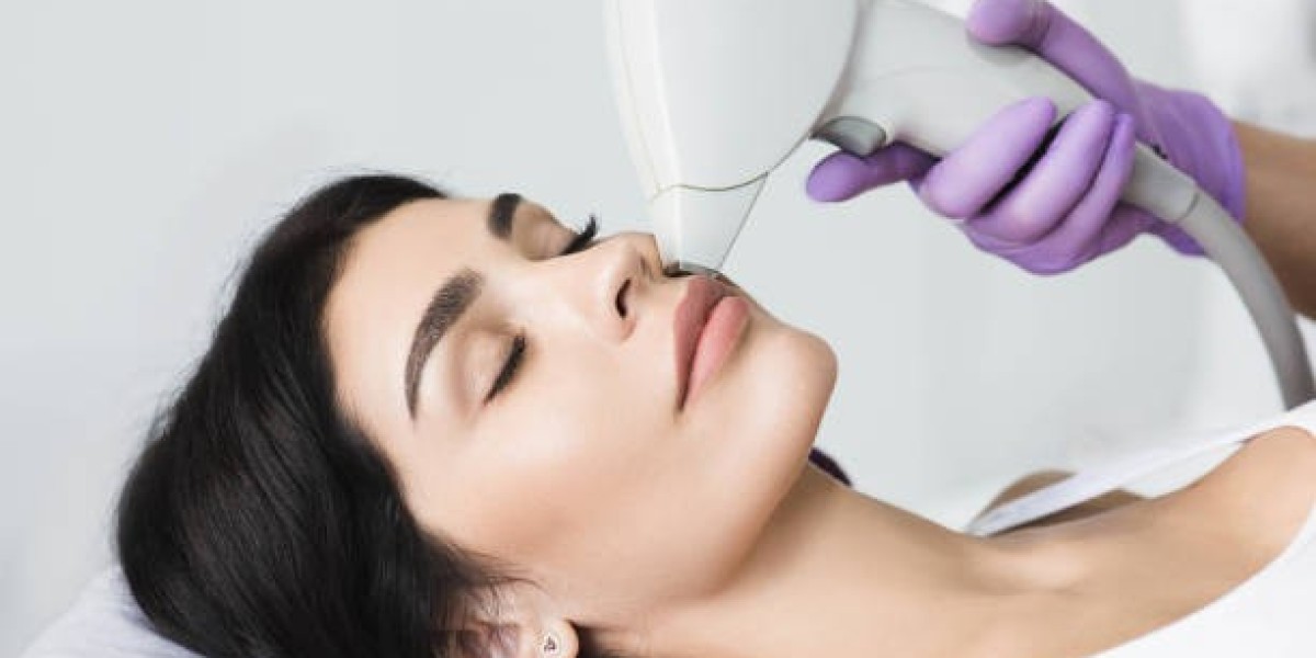 Effortless Hair-Free Skin with Advanced Laser Treatments