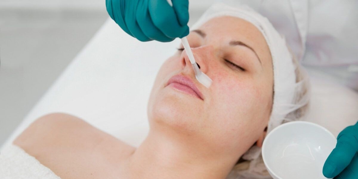 How Is a PCA Peel Treatment Applied?