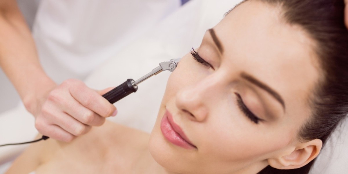 Can Laser Skin Tightening Treat the Neck?