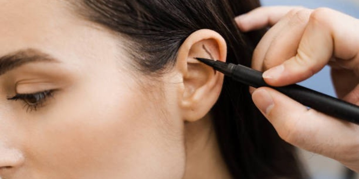 Why Otoplasty in Dubai Is Revolutionizing Ear Reshaping