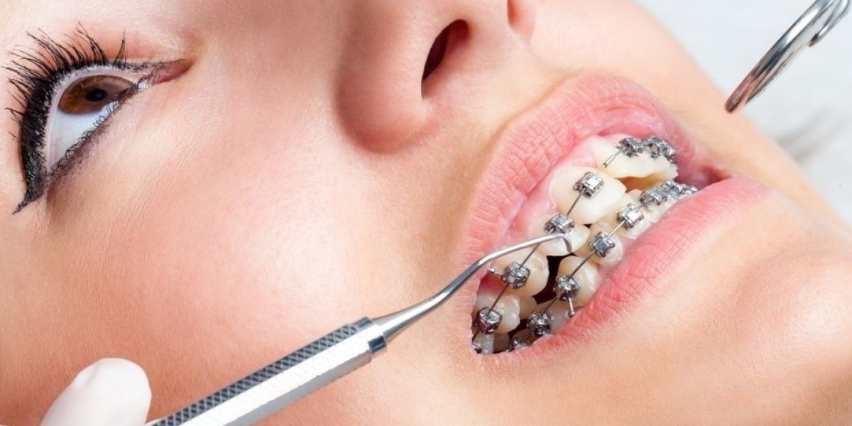 Urgent Dental Care: Fast Relief at Country Dental Brampton