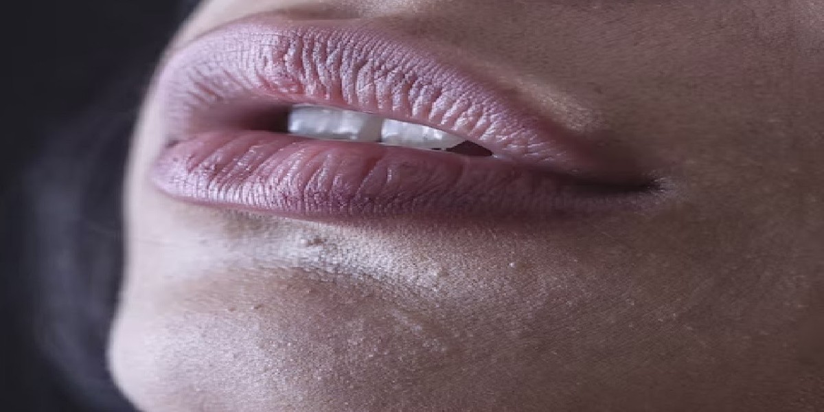 Want fast lip brightening with Smoker’s Lips Treatment?