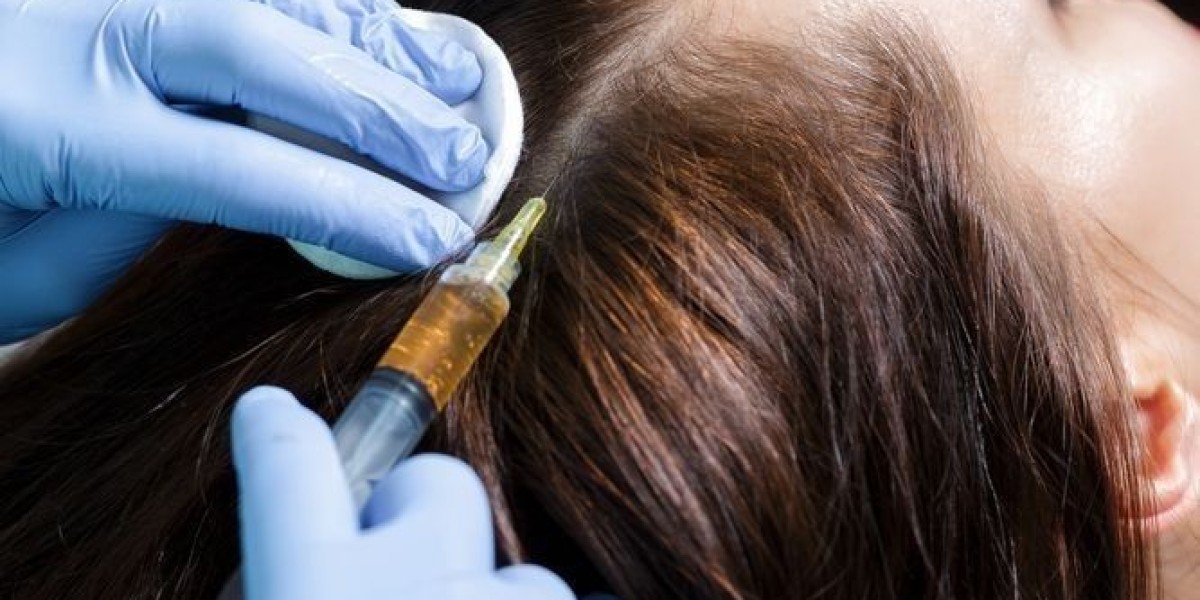 PRP Hair Treatment in Dubai: A Step-by-Step Walkthrough of the Procedure