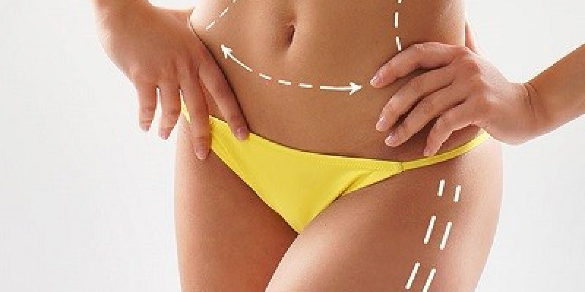 Does SculpSure Permanently Destroy Fat Cells?