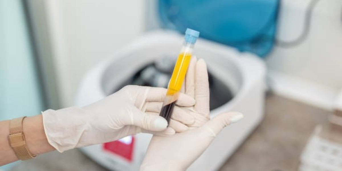 Platelet-Rich Plasma Market Overview: Market Size, Leading Companies & Therapeutic Opportunities