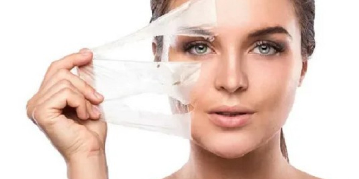 Chemical Peels: Rejuvenate Your Skin for a Radiant Glow