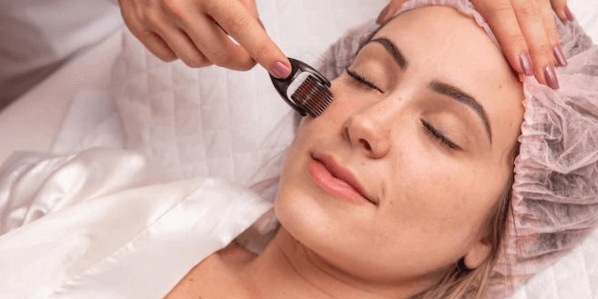 Can Derma Rollers Treatment refine rough areas?