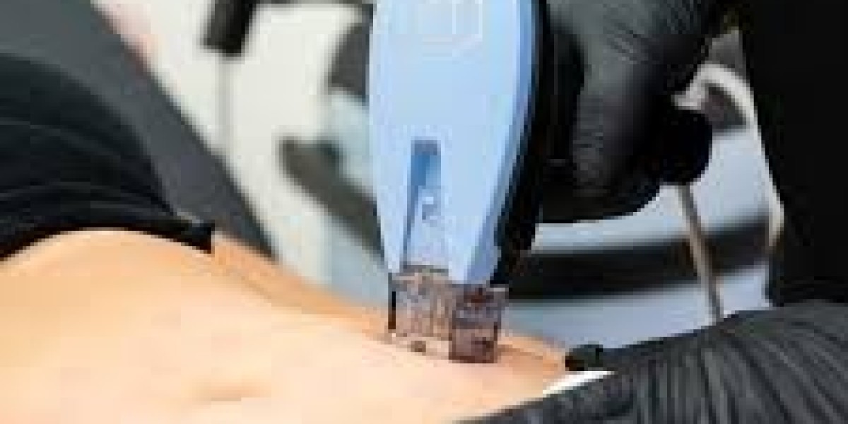 Hair Removal Wilimington NC