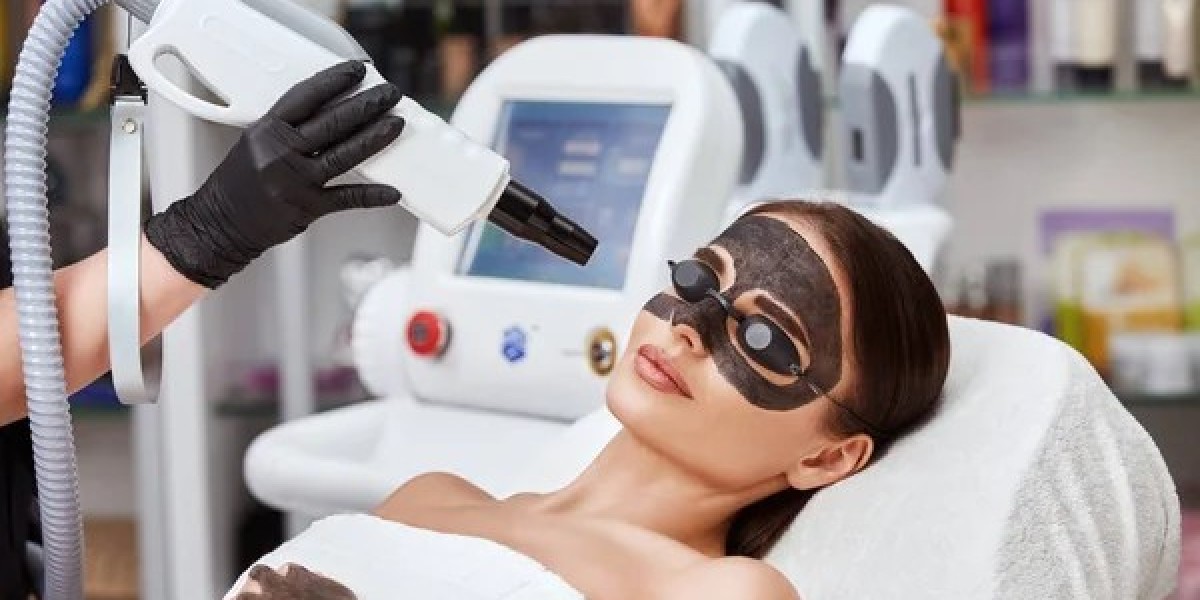 Can a Laser Carbon Peel Help Shrink Enlarged Pores?