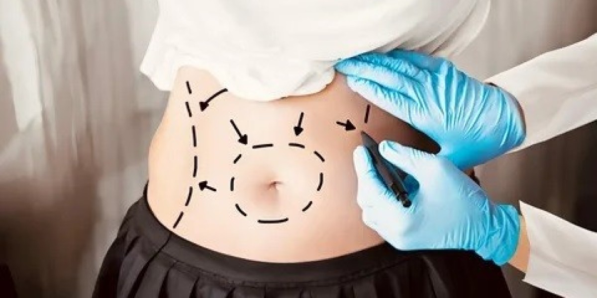 Bariatric Surgery in Islamabad: Types, Benefits, and Expected Results