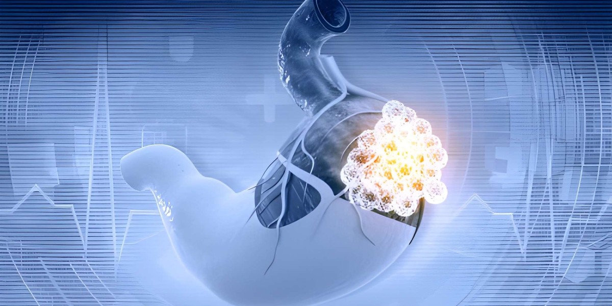 Navigating the Complex Landscape of Neuroendocrine Tumors: Insights, Research, and Market Outlook