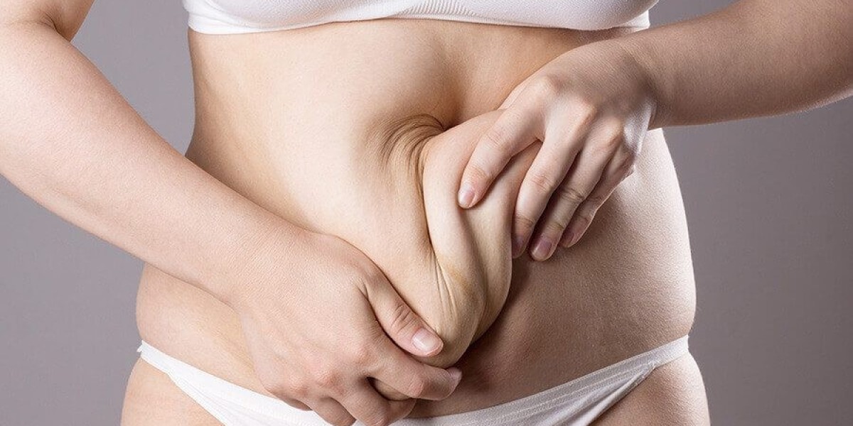 Can a Tummy Tuck Correct a Hanging or Overhanging Belly?