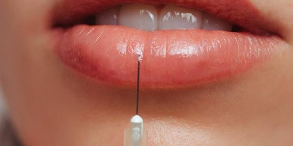 Lip Fillers Injection in Dubai: Avoiding Swelling, Bruising, and Side Effects