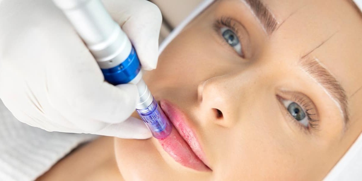 Thinking of trying Smoker’s Lips Treatment for dark lips?