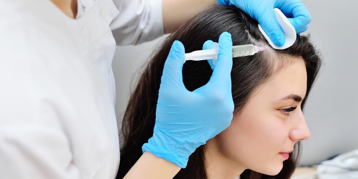 How Is PRP Hair Treatment Performed?