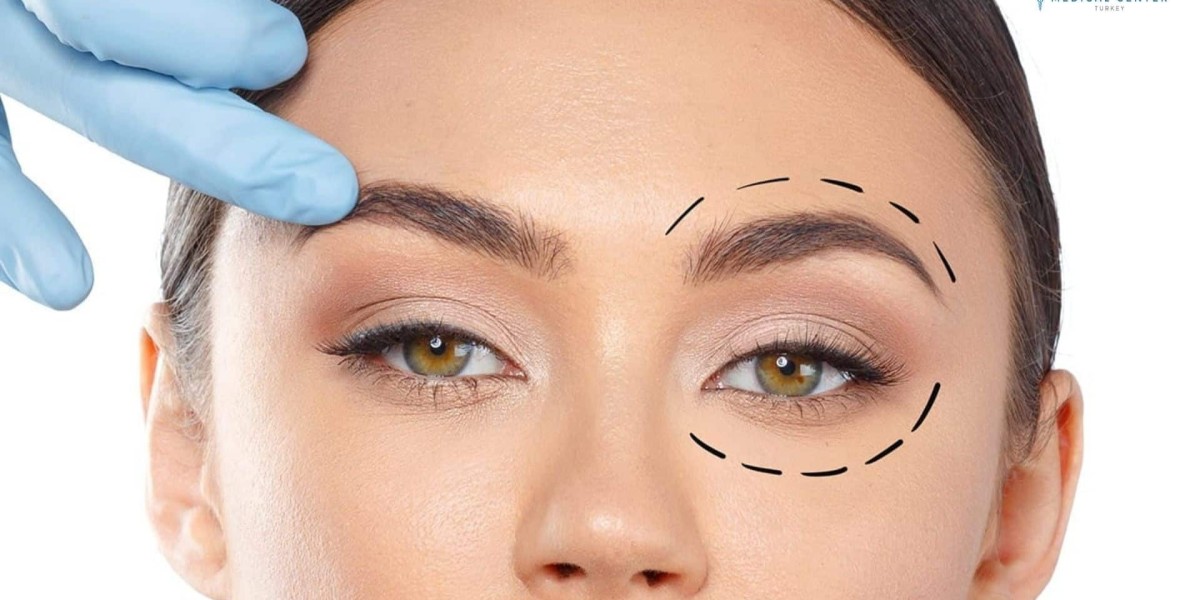Is Eyelid Surgery in Islamabad Worth It?