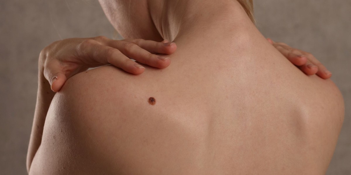 What Are the Reviews for the Best Dermatologist in Dubai?