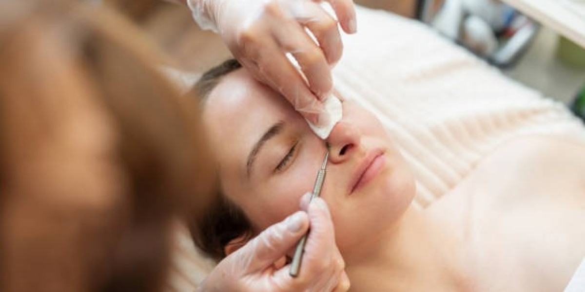 هل يمكن إعادة تعديل الأنف بعد إجراء عملية تجميل الأنف في الرياض؟ ومتى؟