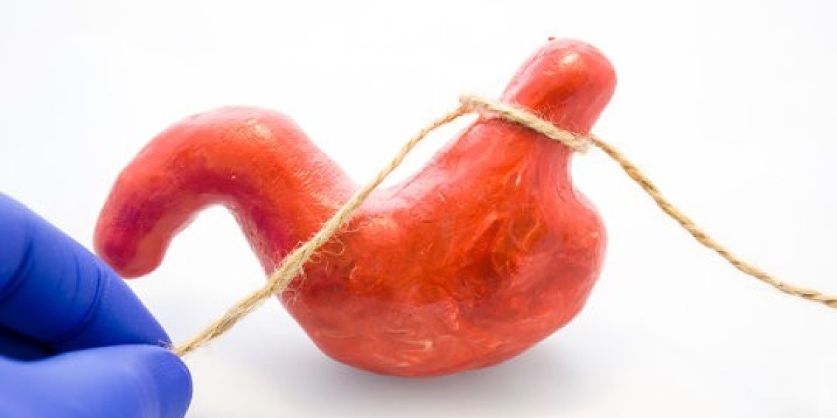 Bariatric Surgery Results: What Islamabad Patients Say