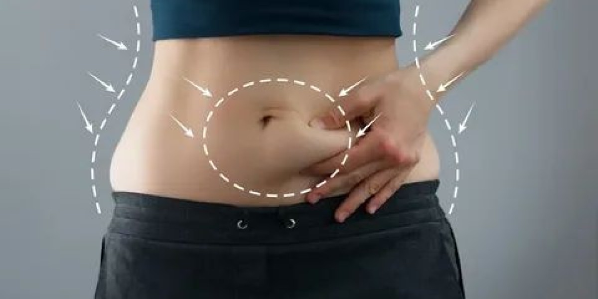 Liposuction in Dubai: How Modern Technology Improves Outcomes