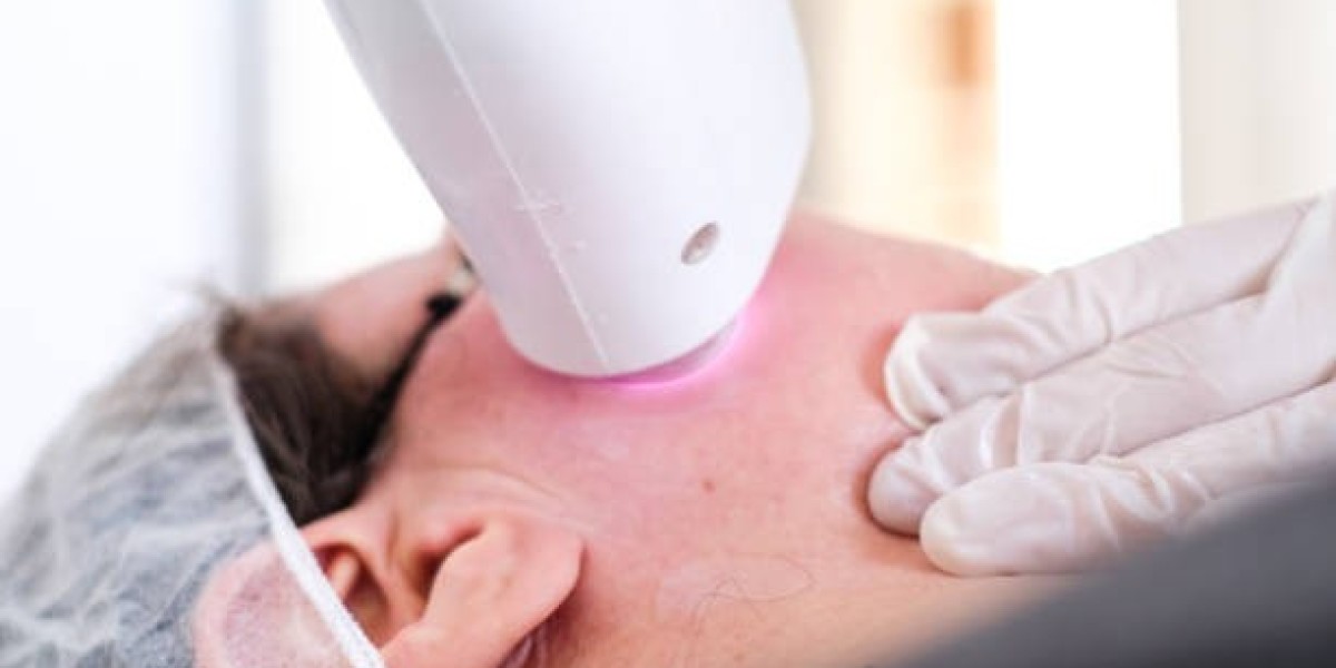 Laser Hair Removal in Dubai for Men and Women: What to Expect