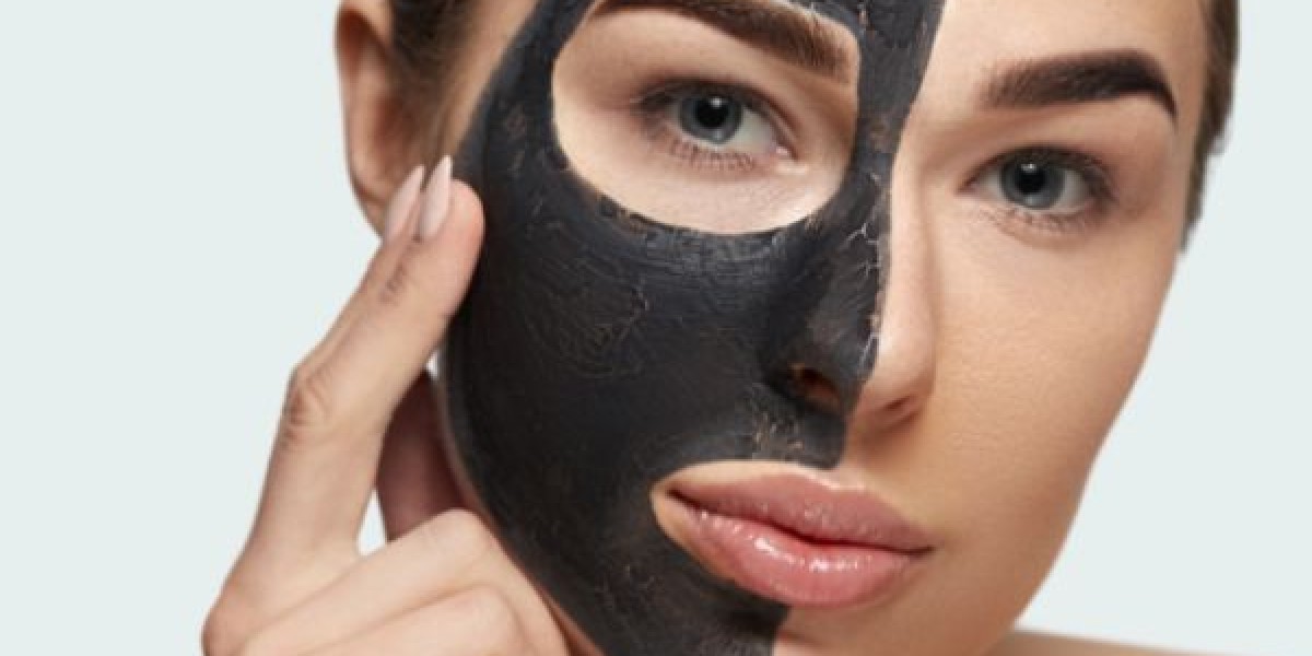 How Often Is A Laser Carbon Peel Recommended For Best Results?